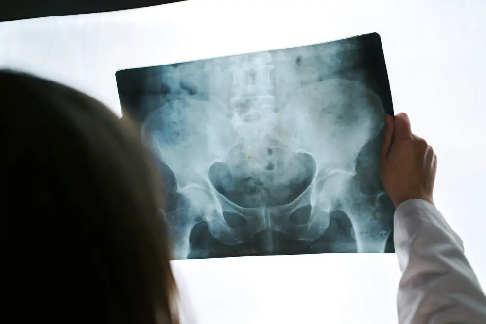 chiropractor looking at a patients x-ray
