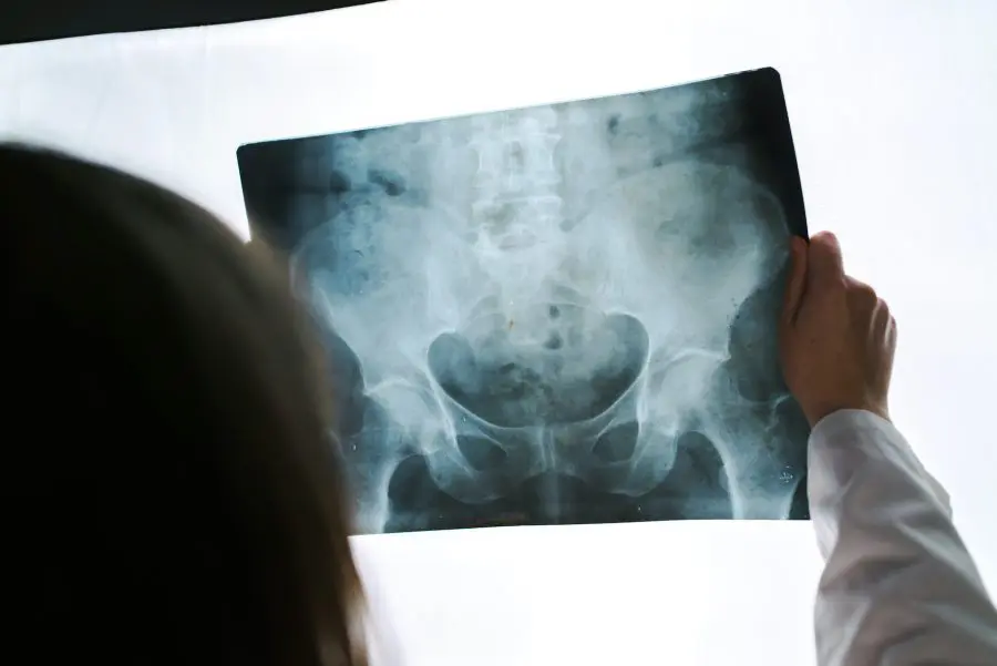 chiropractor holding patients hip x-ray