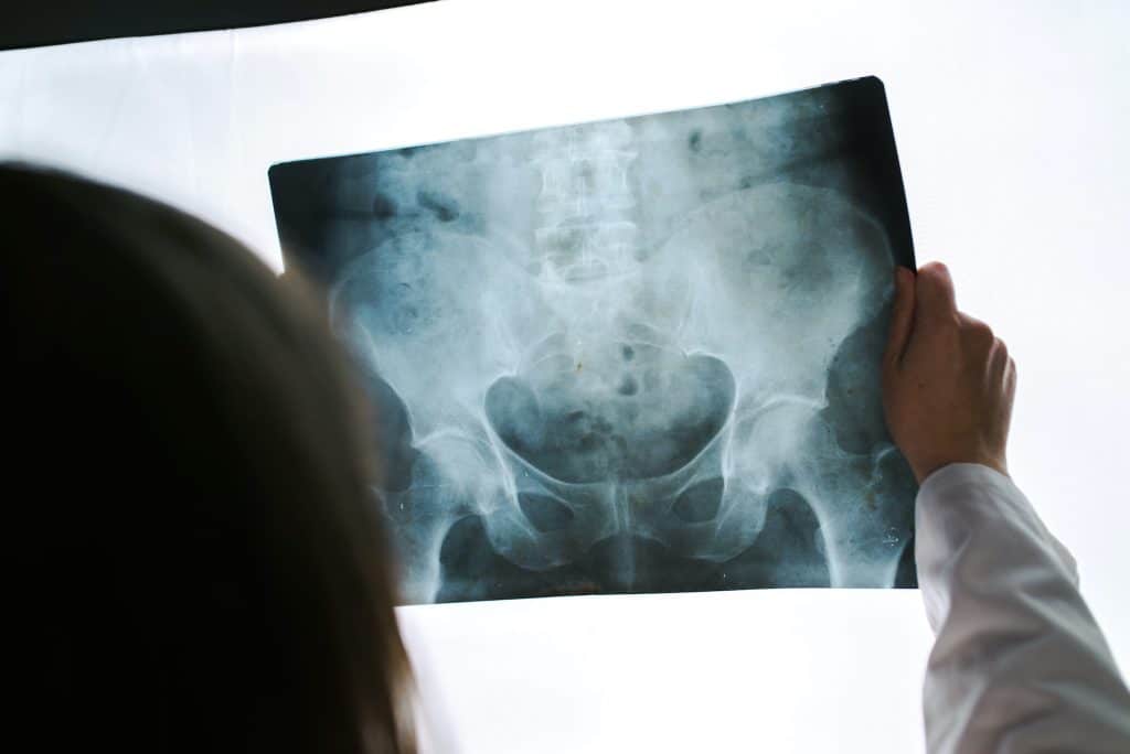 A chiropractor holding up an x-ray image of the pelvis area
