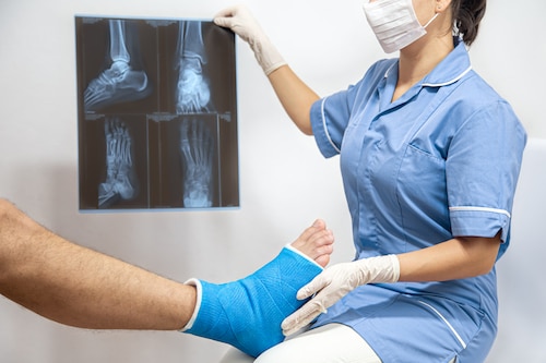 bone sprain and fracture after sports injury accident being assessed through xray by specialist